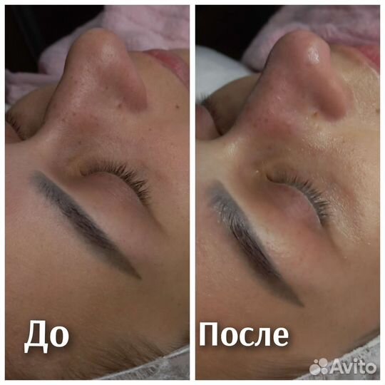 Услуги косметолога косметолог