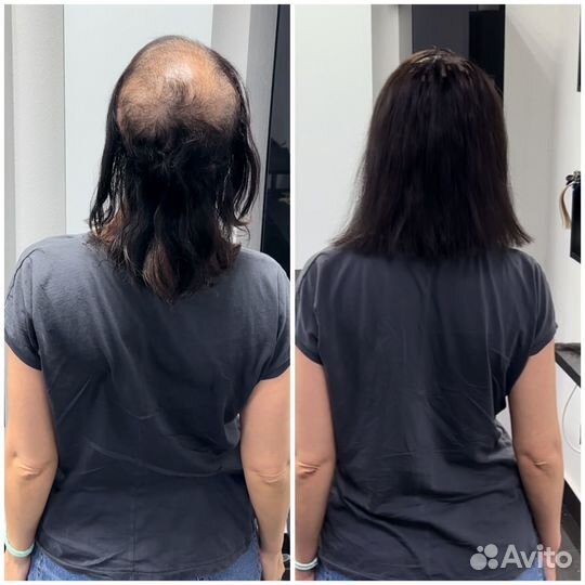 Наращивание Волос скрытым методом