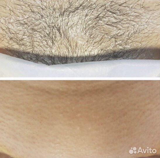 Массаж лица/ депиляция