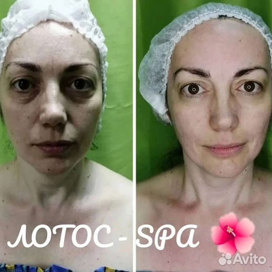 Профессиональный массаж тела и лица