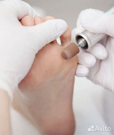 Услуги подолога