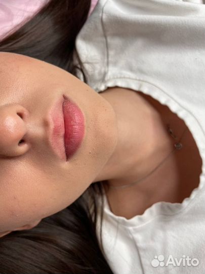 Модель на увеличение губ