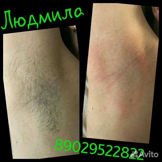 Депиляция воск