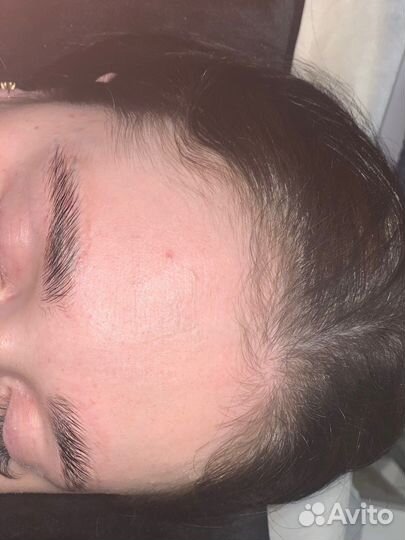 Волосы, пм бровей, губ, кп губ, ботокс