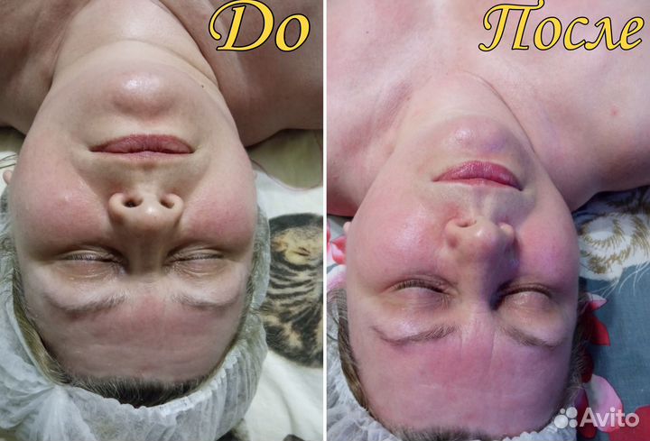 Массаж лица/ классический массаж. Для женщин