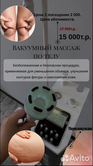 LPG массаж, Вакуумный, RF