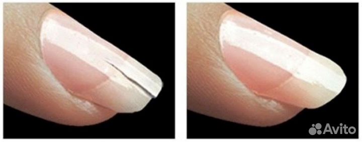 Медицинский педикюр подолог