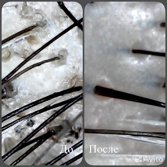 Трихолог-эстетист/технолог/реконструкция волос