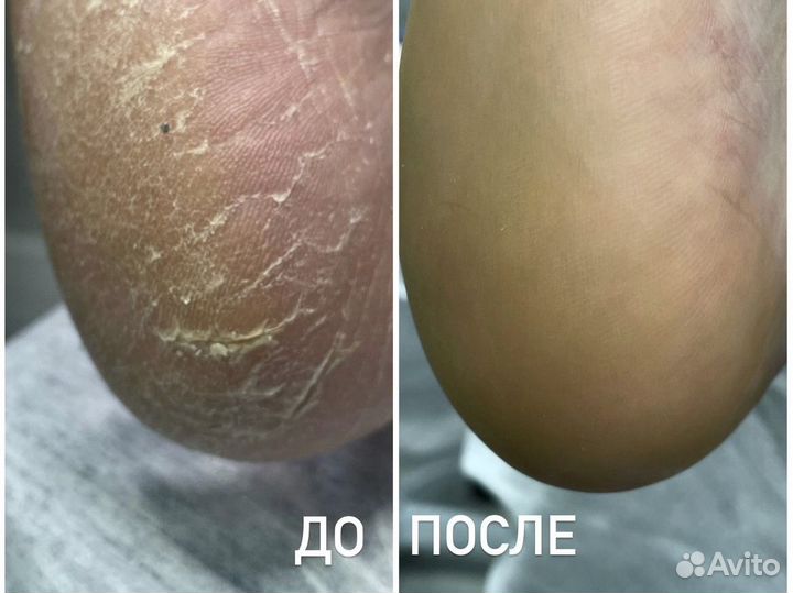 Подолог с выездом на дом