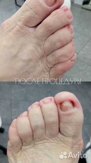 Услуги мастера педикюра, подолог