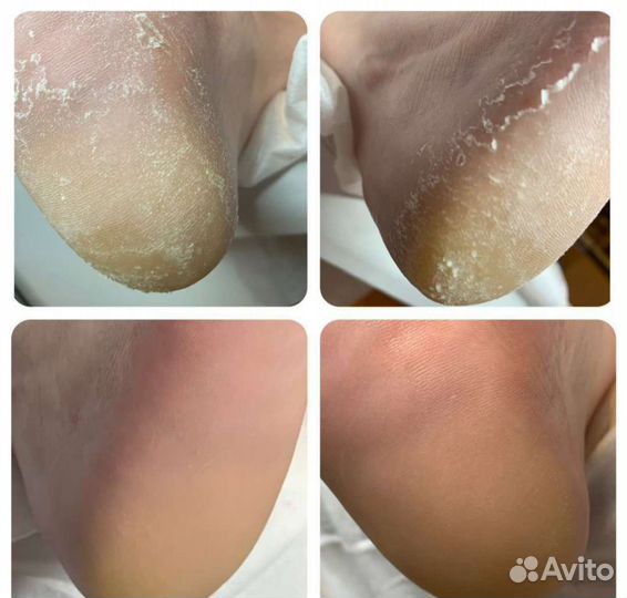 Маникюр педикюр на дому