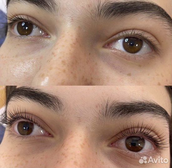 «Ботокс» для волос