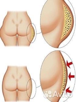 Красота и здоровье, аппаратный массаж