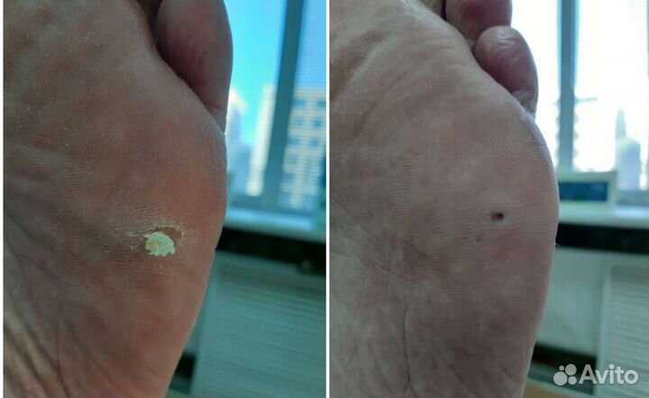 Подолог Педикюр Маникюр