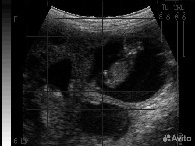 Узи диагностика козы/овцы