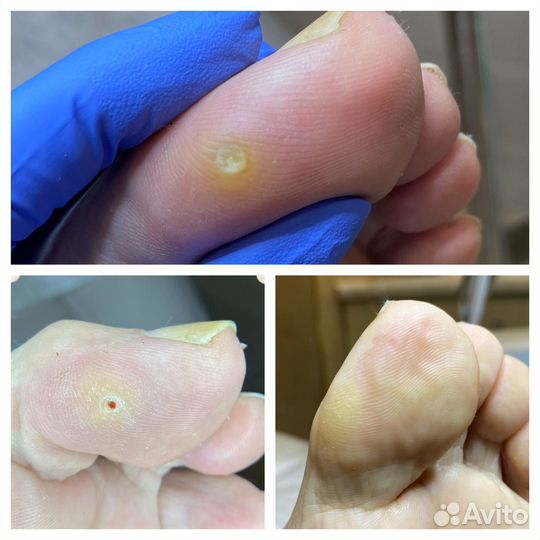 Услуги подолога