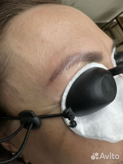 Удаление татуажа и тату лазером / ремувером