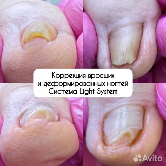 Педикюр с выездом на дом