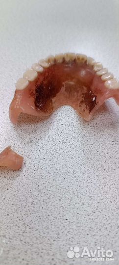 Изготовление и починка съёмных зубных протезов