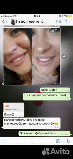 Набор для отбеливания зубов Ivismile