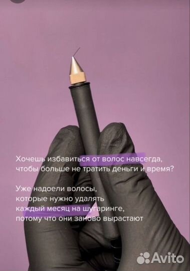 Электроэпиляция