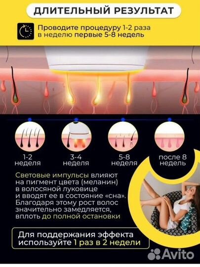 Фотоэпилятор лазерный