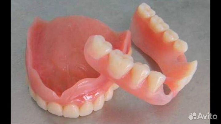 Ремонт зубных протезов