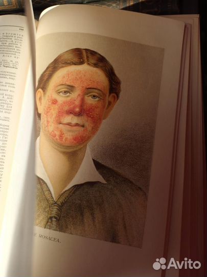 Большая Медицинская энциклопедия 20х-30х годов