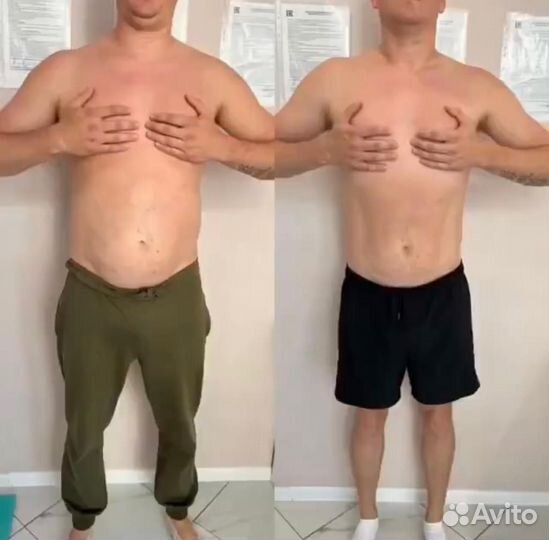 Курс Криолиполиза для мужчин