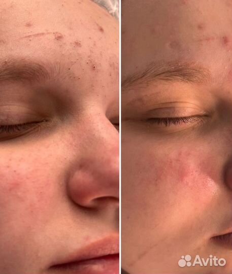 Услуги косметолога