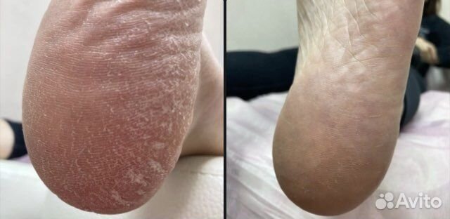 Мастер маникюра педикюра, оформление бровей