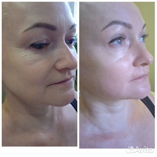 Массаж лица