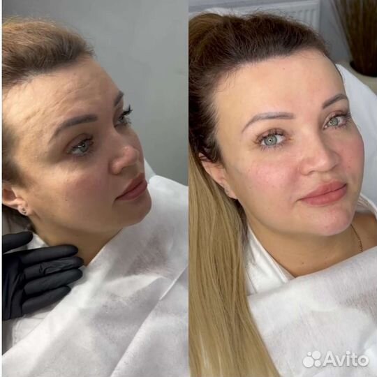 Услуги косметолога