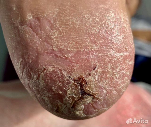 Подология и эстетика