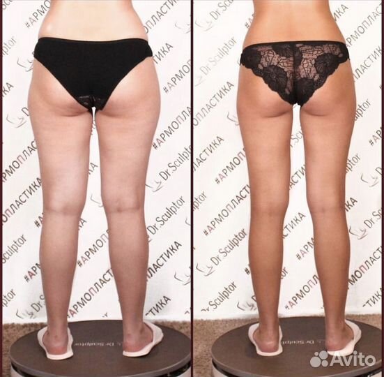 Армопластика