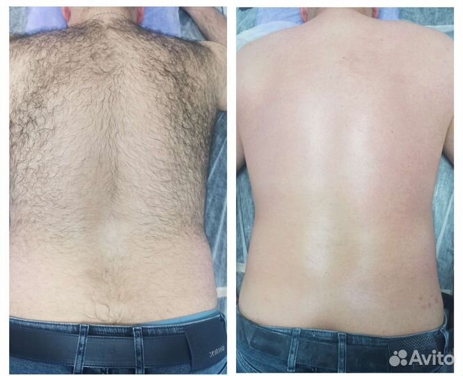 Депиляция воском мужская /женская