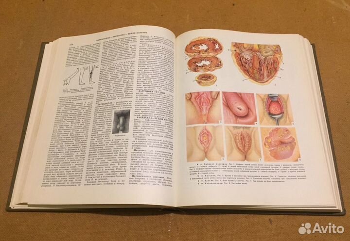 Краткая медицинская энциклопедия (том 1)