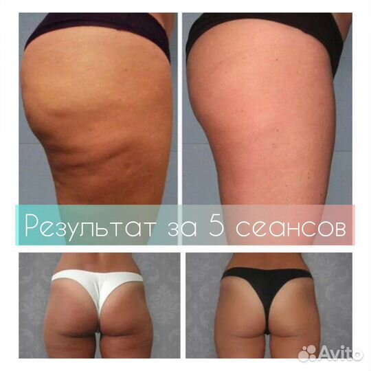 Слёзы бывших - пробный сеанс 