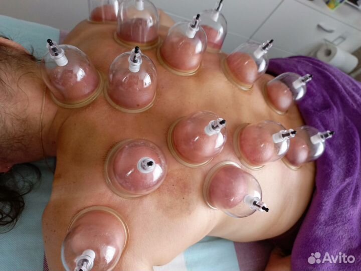 Баночный массаж