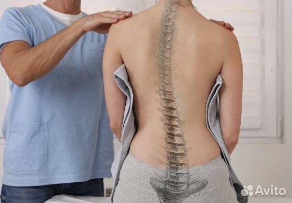 Массаж при сколиозе и искривлени позвоноч отдела