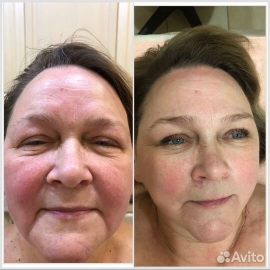 Практикующий массажист. Массаж лица