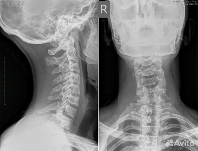 Костоправ Иваново