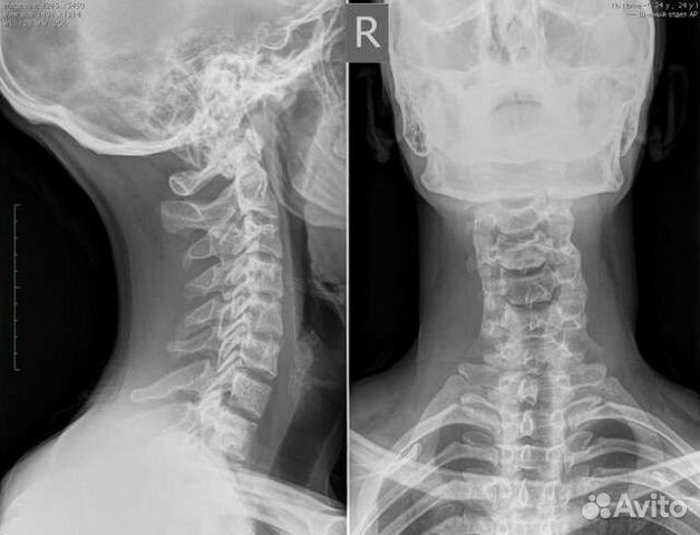 Костоправ Иваново
