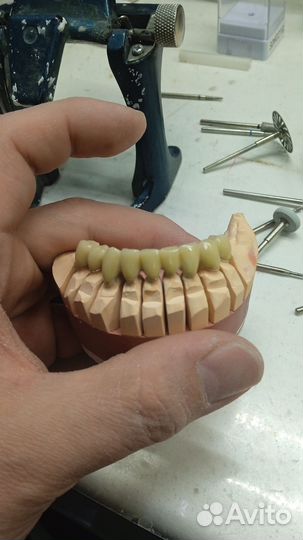 Услуги зубного техника