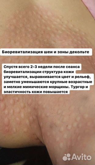 Услуги косметолога
