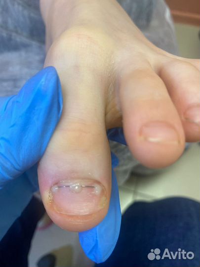 Маникюр,педикюр, наращив-е, ламинирование, подолог