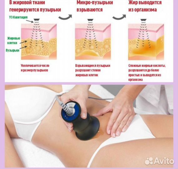 Миостимуляция тела