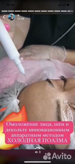 Холодная плазма