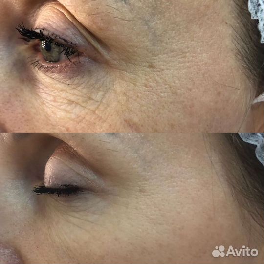 Услуги косметолога