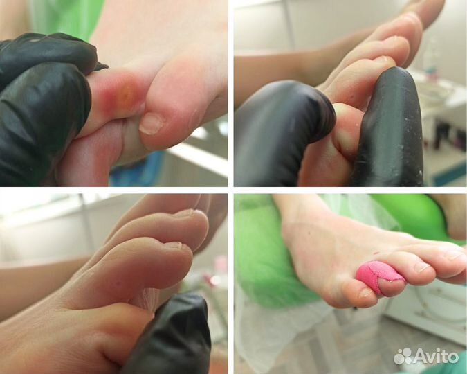 Маникюр, педикюр, депиляция, косметолог, подолог